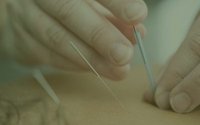 Acupuncture